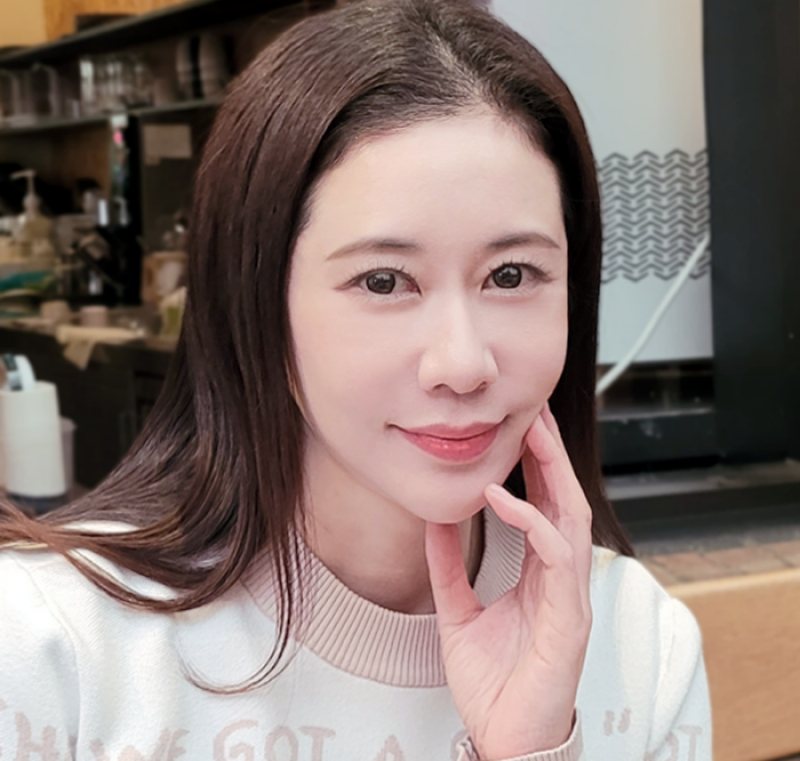 리프팅 후기 사진