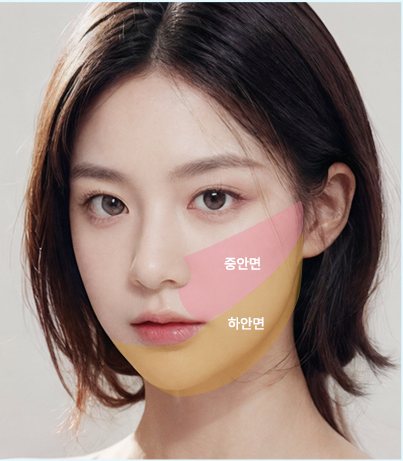 투명 V - A타입 중안면·하안면