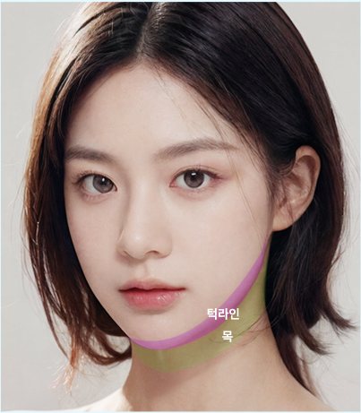 투명 V - N타입 턱라인·목