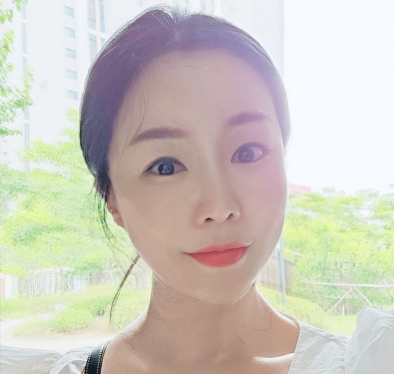 리프팅 후기 사진
